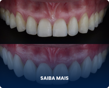 Exemplo 2, Imagem de procedimento bem feito
